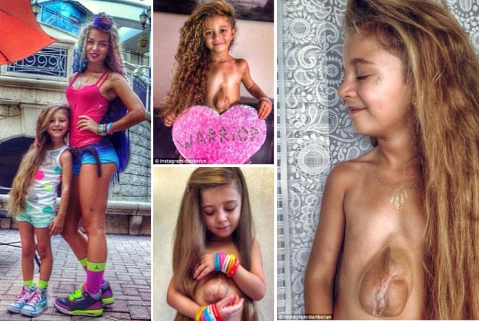 Masya Allah..... Jantung dan Usus Gadis Cilik Rusia di Luar Dada dan Perutnya